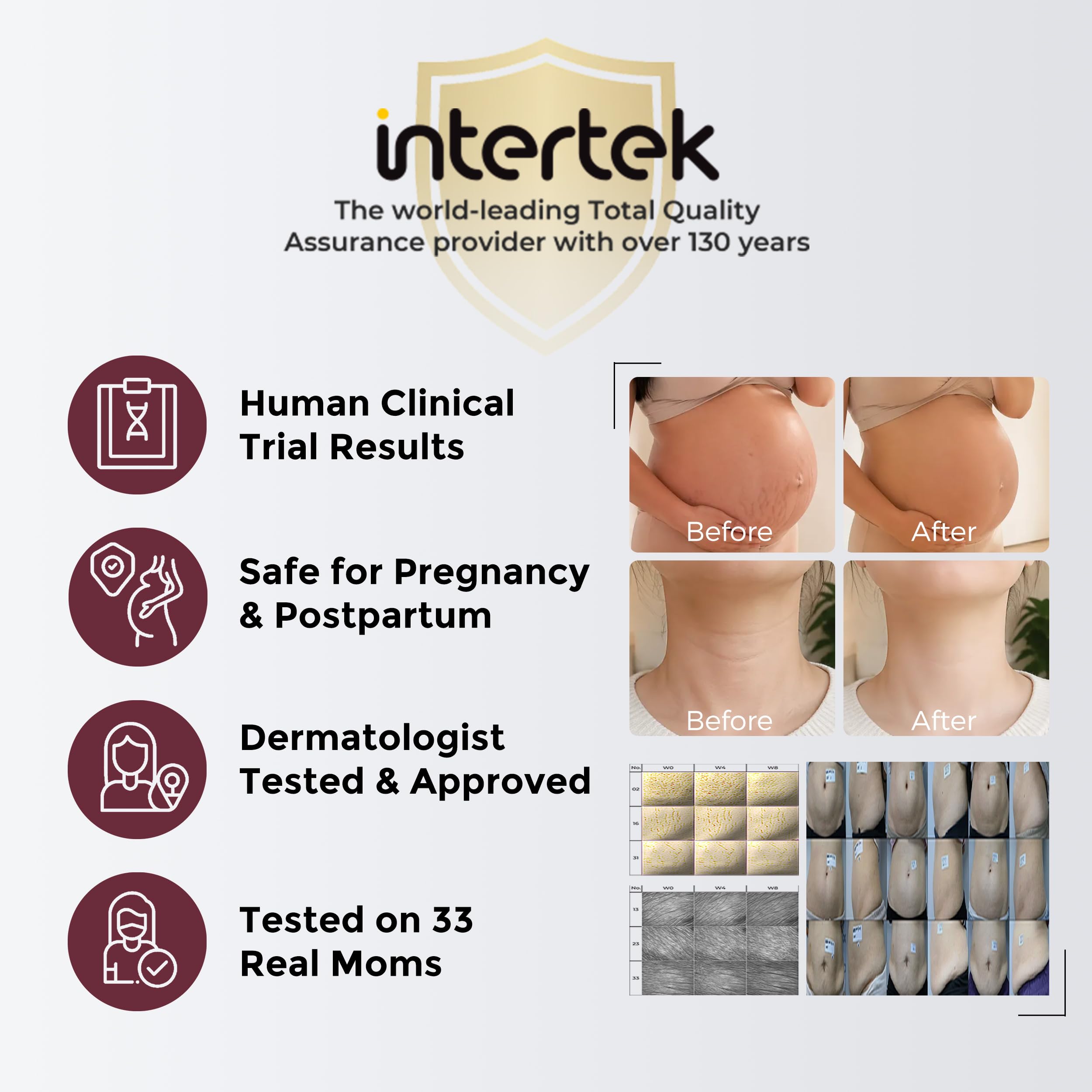 momcozy-stretch-mark-cream-ewg-verified-dermatologist-tested-with-4x-peptides-ce image 5
