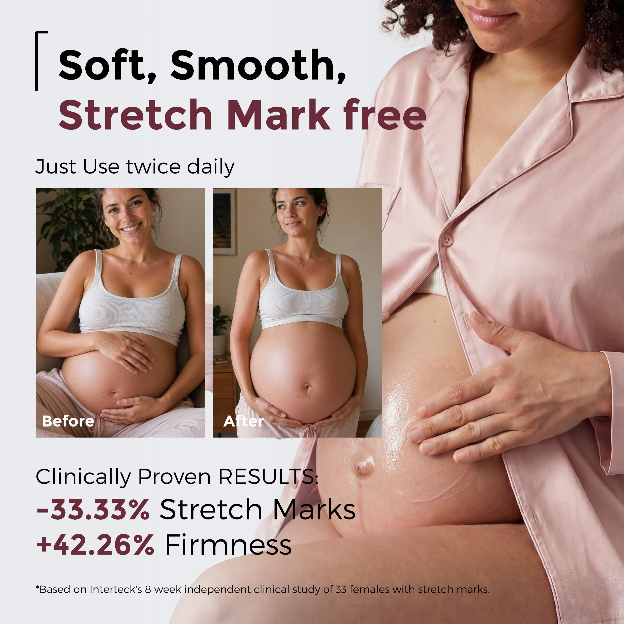 momcozy-stretch-mark-cream-ewg-verified-dermatologist-tested-with-4x-peptides-ce image 3